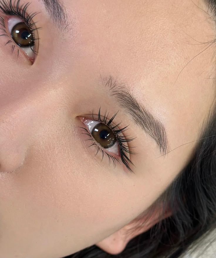 Striking doll-eye effect